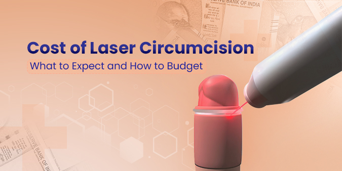 Cost of Laser Circumcision: What to Expect and How to Budget